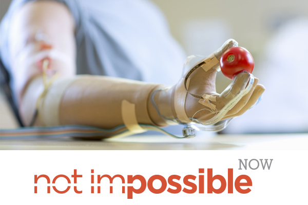 A Hand Instead of a Tool: New Prosthetics Offer Increased Touch-Sensitivity