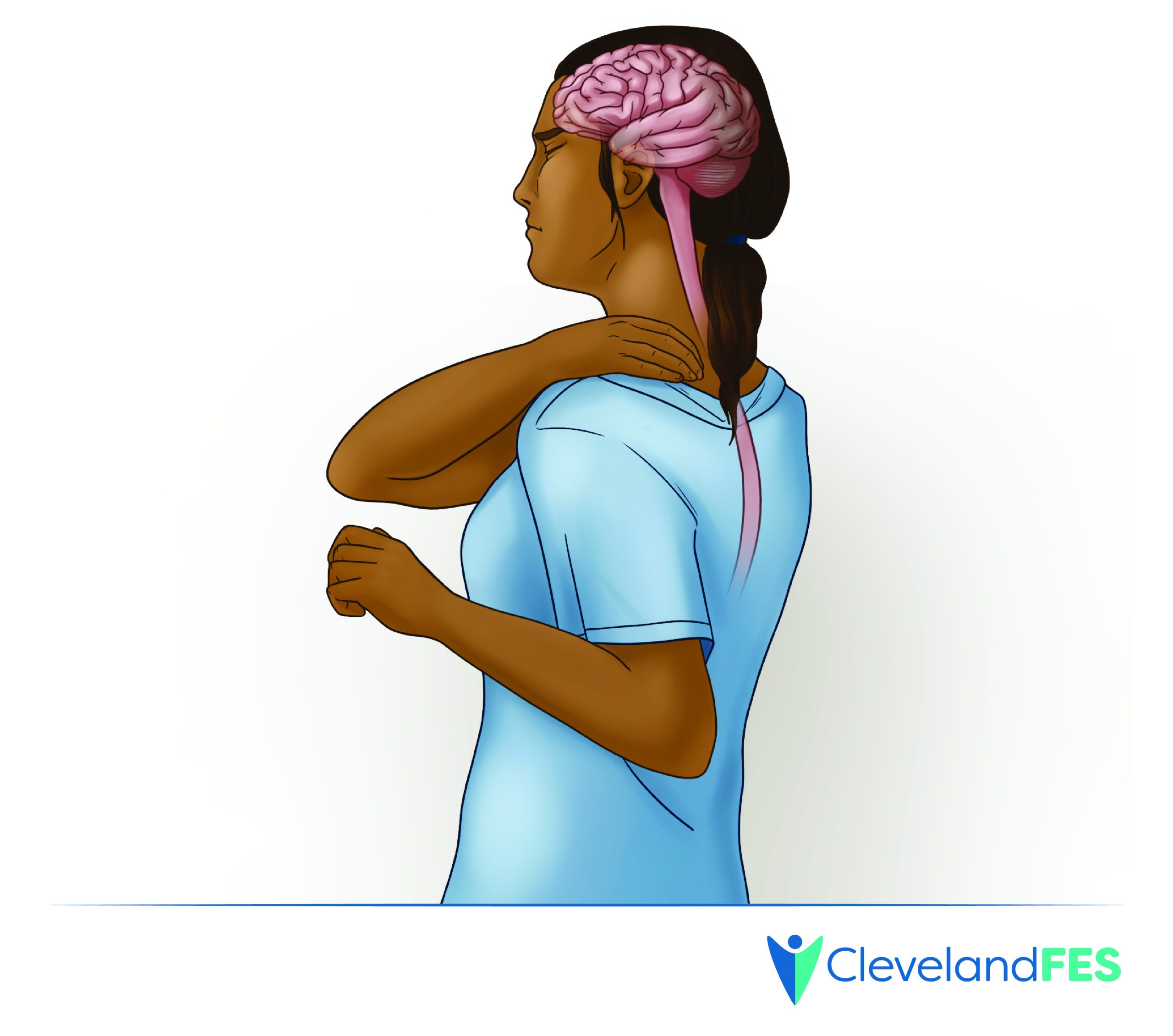 Illustration related to pain relief and neuromodulation