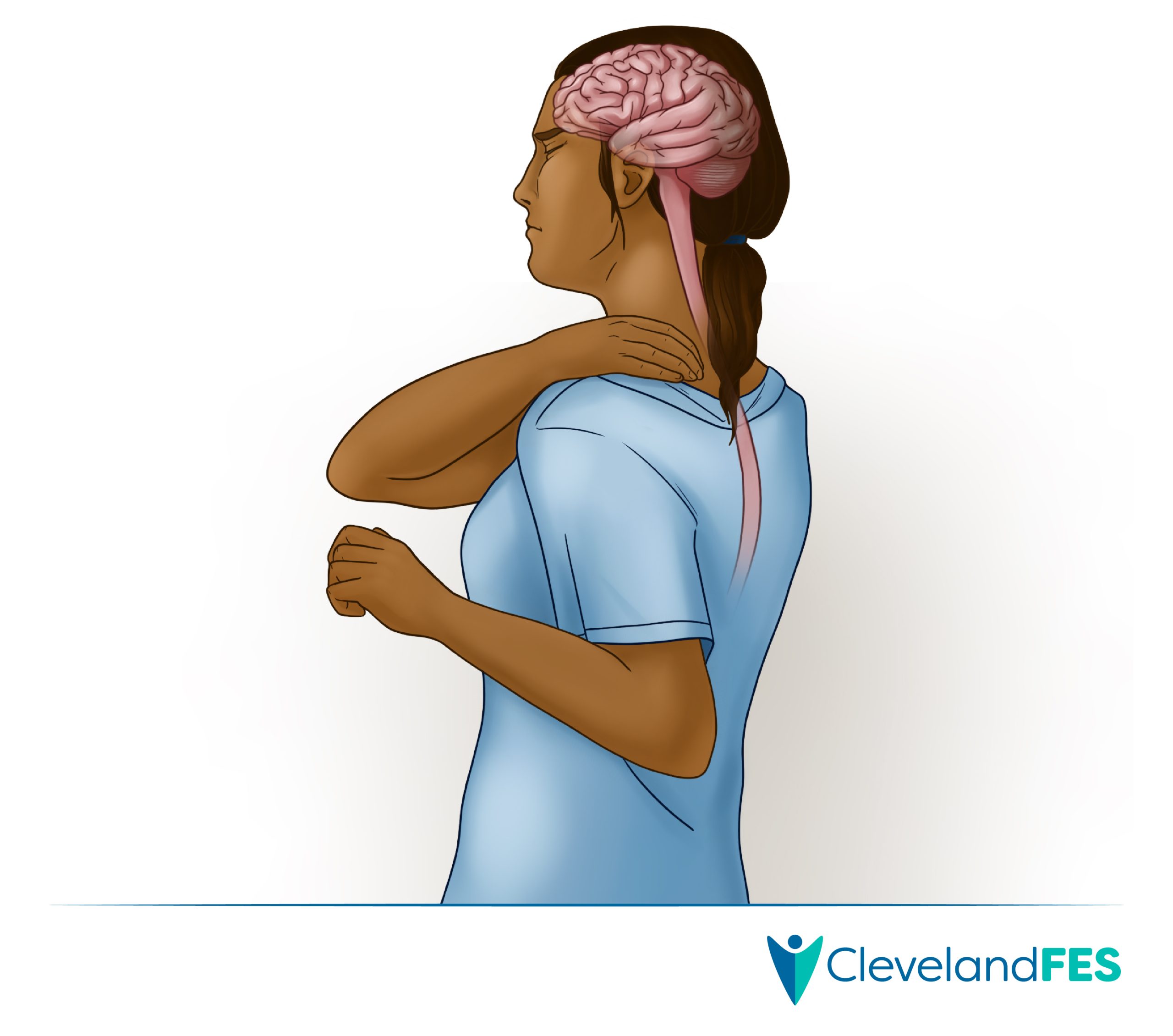 Illustration related to pain relief and neuromodulation