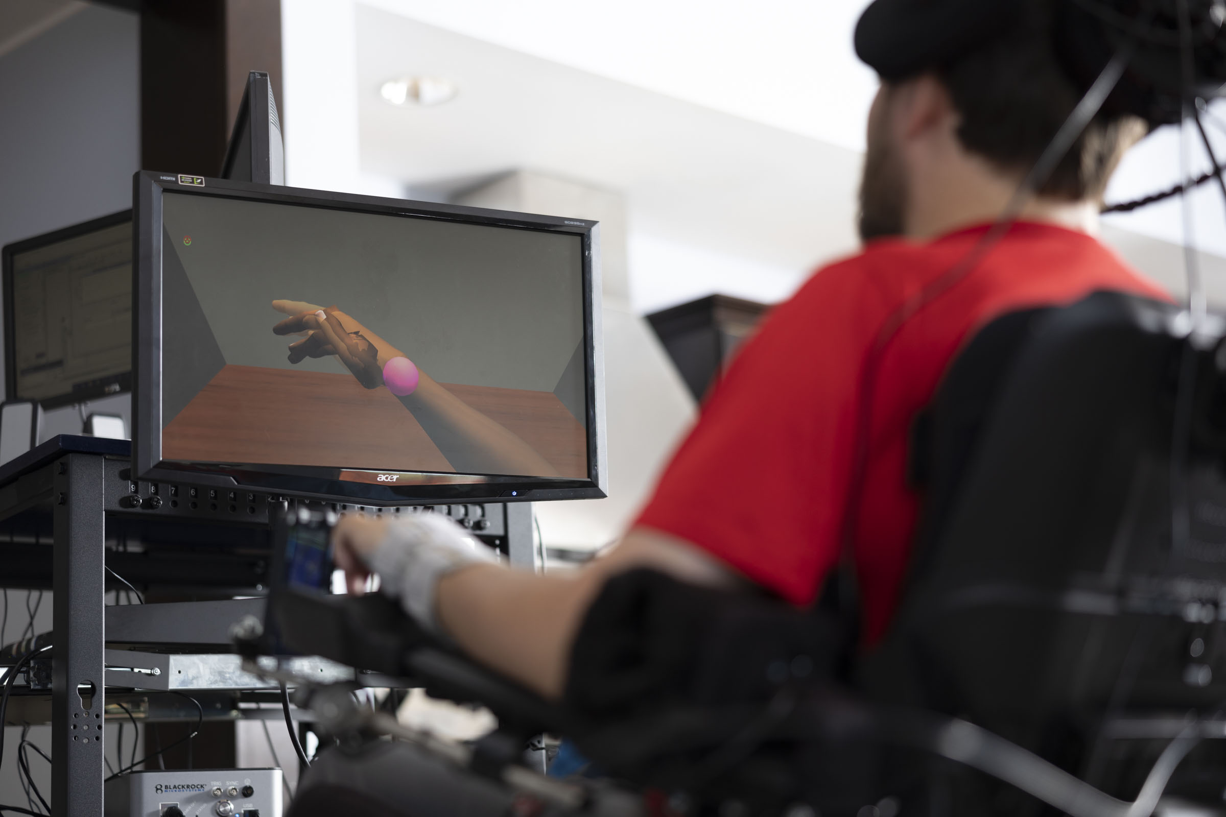 Upper extremity study image 3