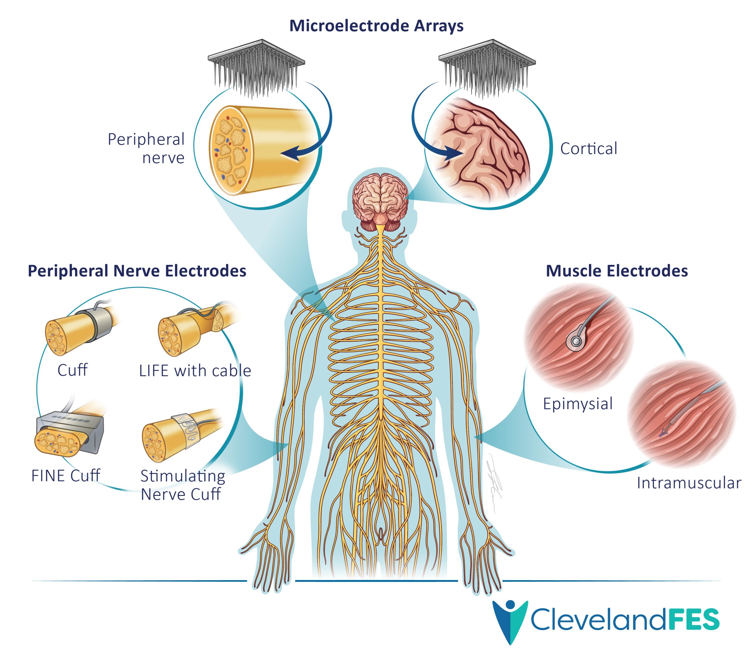 Neuromodulation research illustration