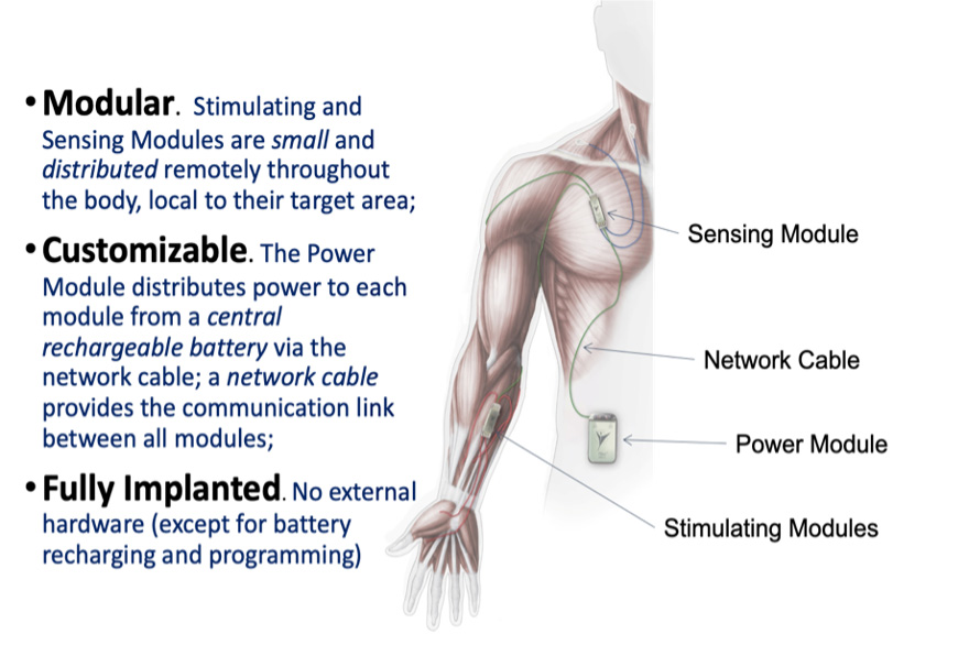 Illustration of the implanted networked neuroprosthesis device