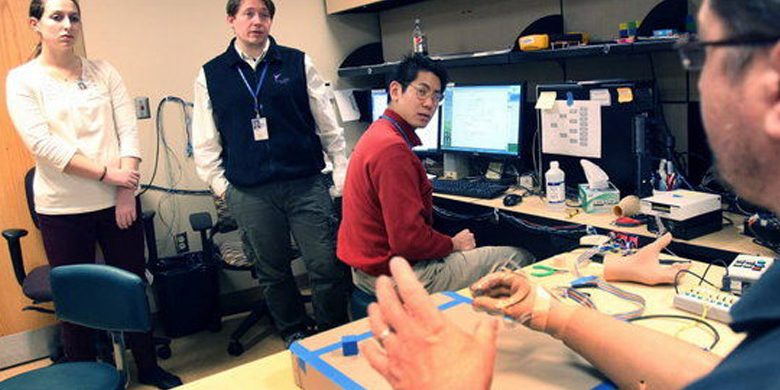 fes-prosthetic-hand-post