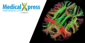 brain-300×151