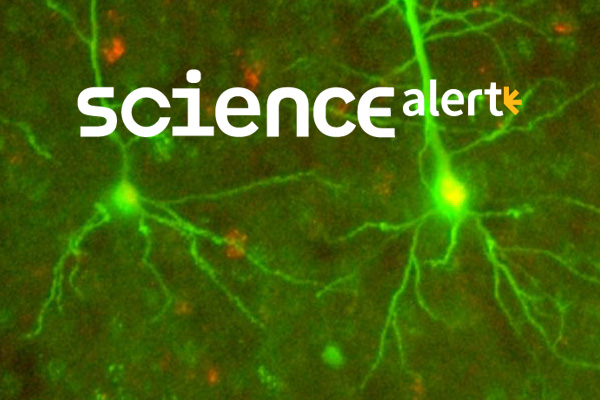 DurandScienceDaily