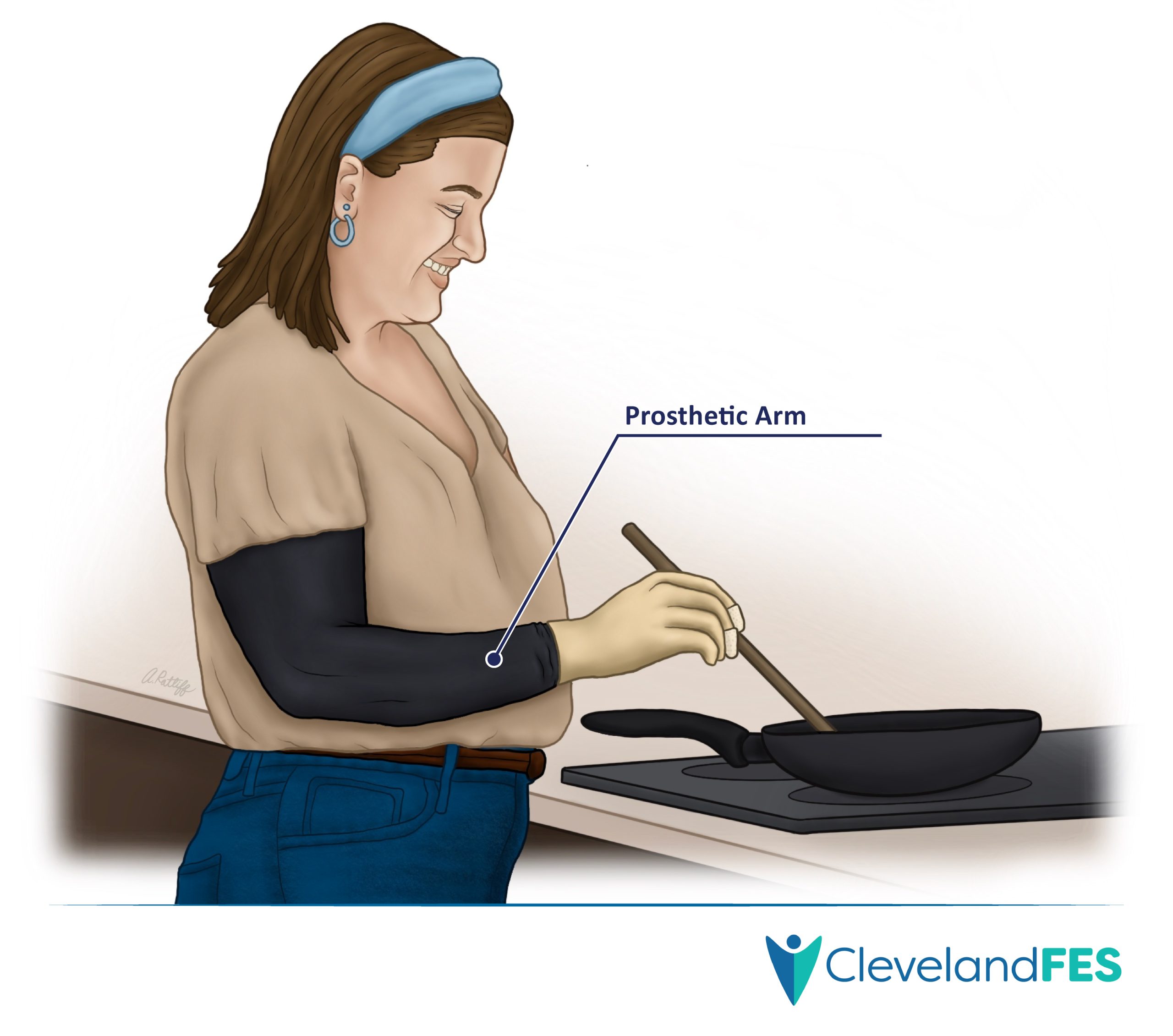 Person using a prosthetic limb