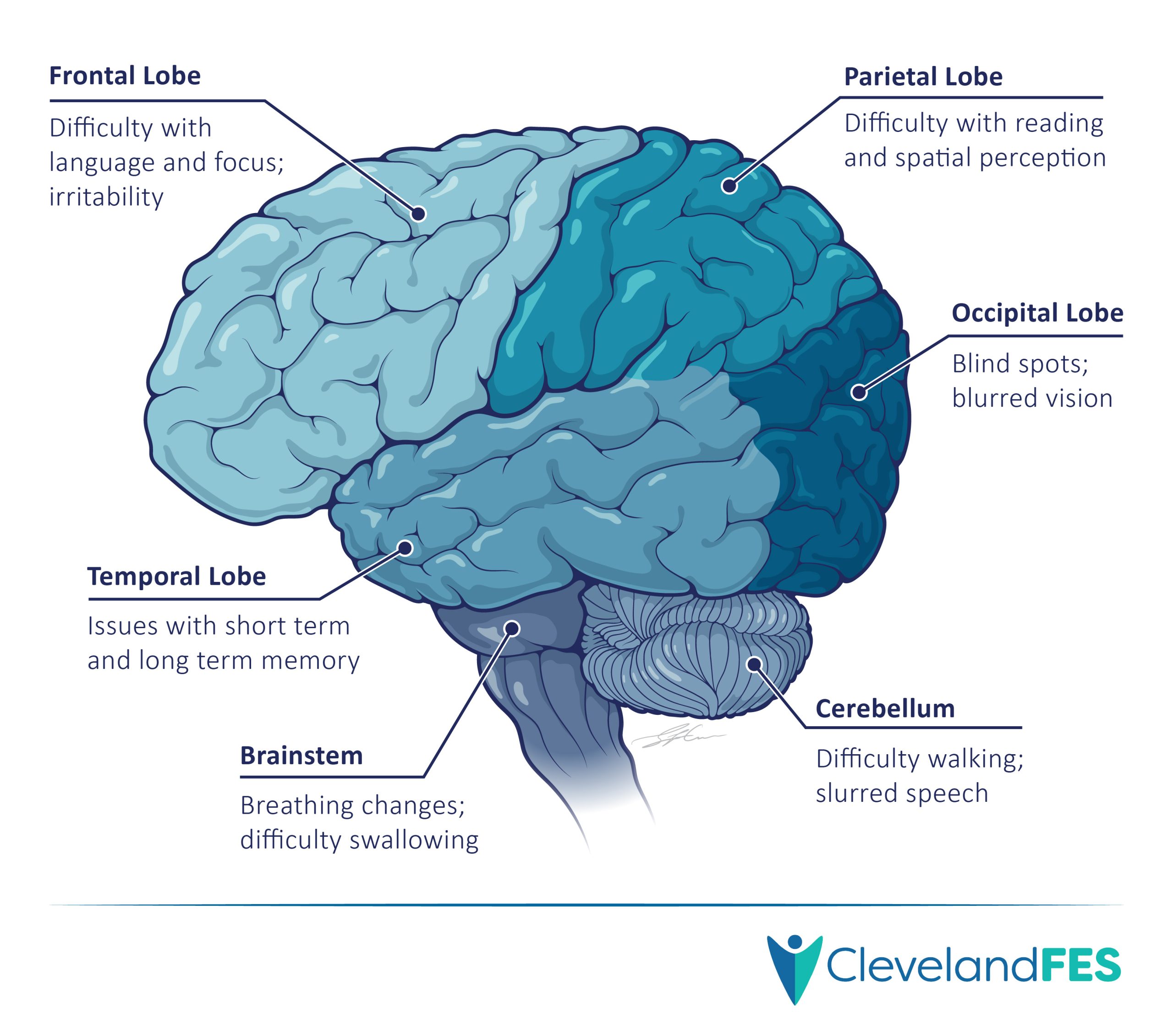 Traumatic brain injury illustration placeholder